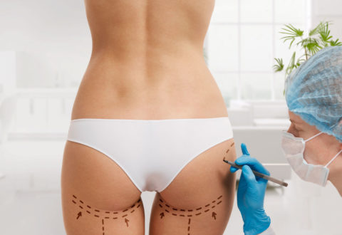 Plastic Surgery itinerary in istanbul Day 2